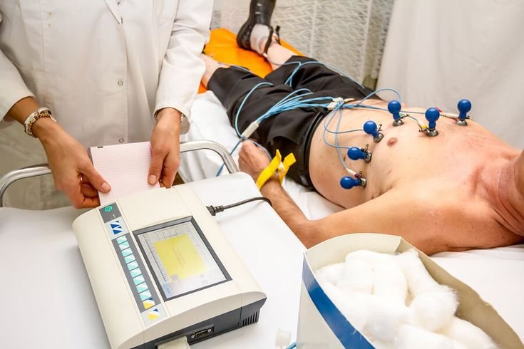 ECG