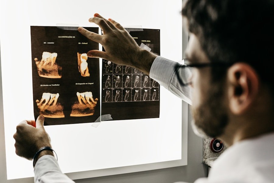 MRI Scan Suite