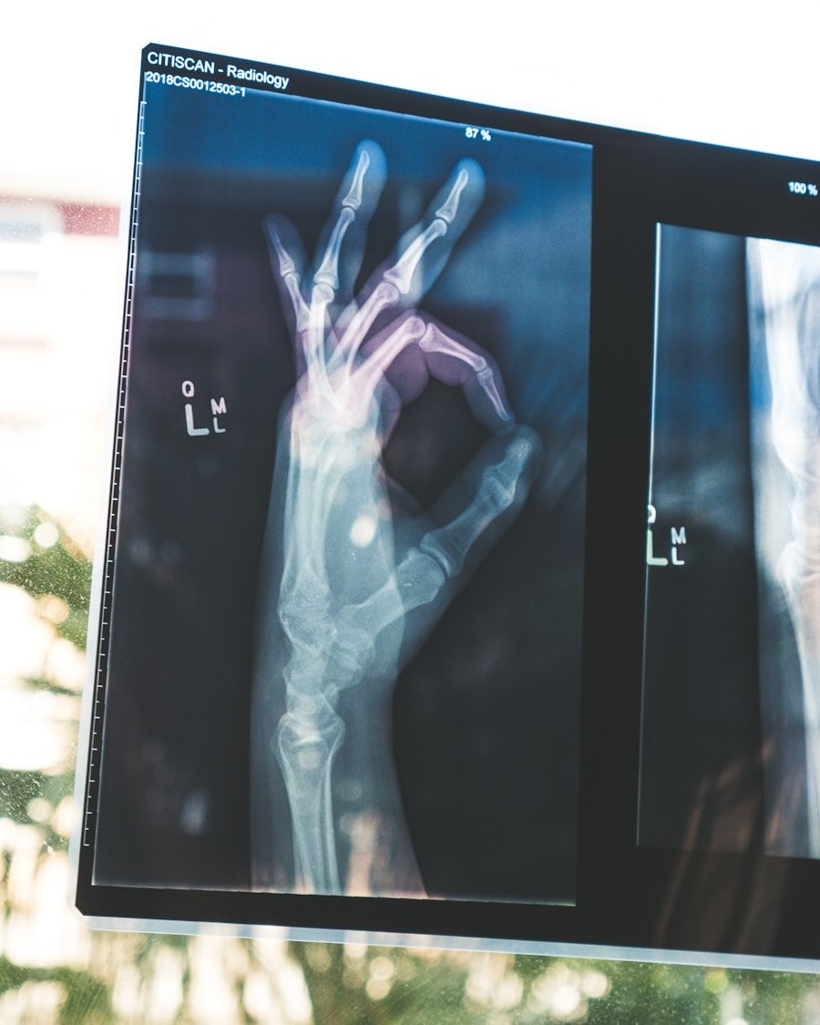 Digital Radiography Unit